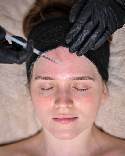 Microneedling med C-vitamin